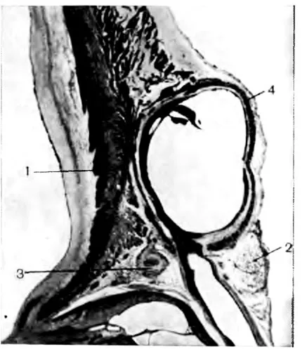 Coronariană sinusală - Anatomia clinică a inimii