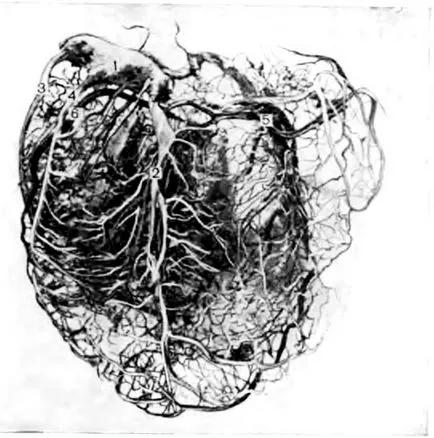 A koszorúér sinus - klinikai anatómiája a szív