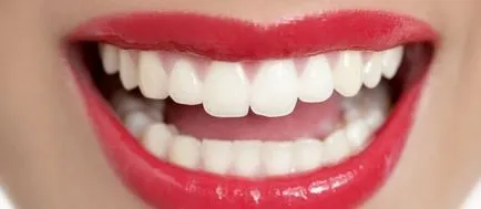 Привеждането на зъбите без скоби разходите и методи