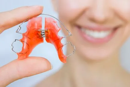 Подреждането на зъбите Какви са опциите