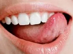 Inflamarea papilelor pe limba