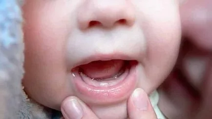 Hány hónap első fogak megjelennek a gyermek