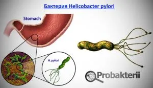 Helicobacter pylori în tratamentul medicatie de stomac si populare remedii, comentarii