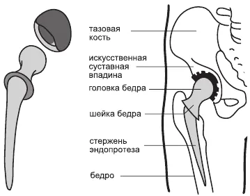 хірургічне лікування