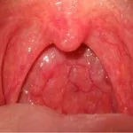 boli orale cauze, simptome și tratament