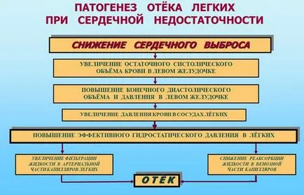 Течност в белите дробове по време на сърдечна недостатъчност - причини, симптоми, лечение, прогноза