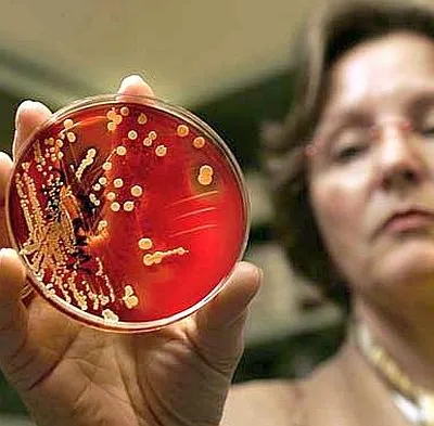 Staphylococcus aureus az orrban, kocsi, kezelésére MRSA - orvostudomány és egészségügy a világ