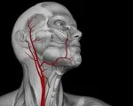 Aneurysm carotis - Causes, tünetek és kezelés