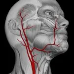 Anevrismul arterei carotide - cauze, simptome și tratament