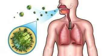 Amigdalite bacteriene cum să se facă distincția modul de a trata copiii