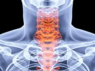 Cervicalgia (vertebrogena) Simptome si tratament