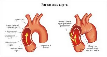 Бифуркация - тя се раздели трахеята, аортата и сънната артерия