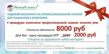 Деймън се подготвя система с 15% отстъпка