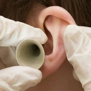 Gyakori fülfertőzések a gyermekek, az okokat, mi a teendő