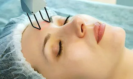 Curățarea cu laser facial