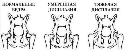 Hip dysplasia okai és kezelése a betegség