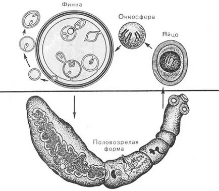 Echinococoza ce este și ce fel de tratament