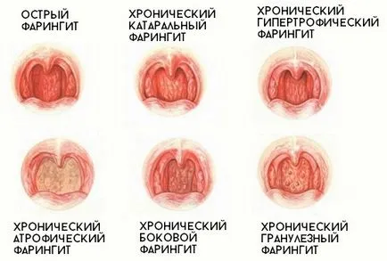 Какво да правите, ако детето ви е с кашлица продължава за един месец