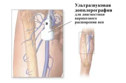 Колко често мога да направя Узи