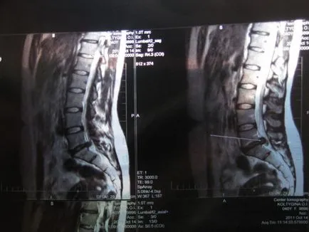 Ceea ce arată o radiografie a coloanei vertebrale 1