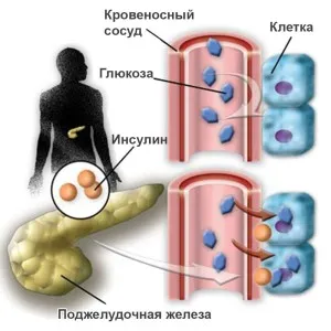 Așa cum apare diabetul