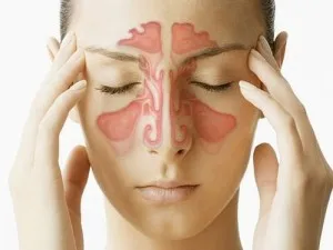 Hogyan feküdt egy komplex kenőcs az orr, a sinus