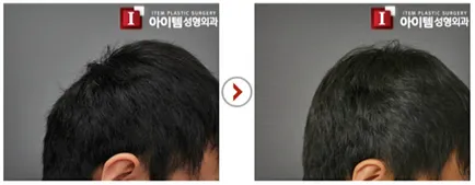 Koreaiak soha többé meghökkent! A vizsgált változók fej profil, online magazin