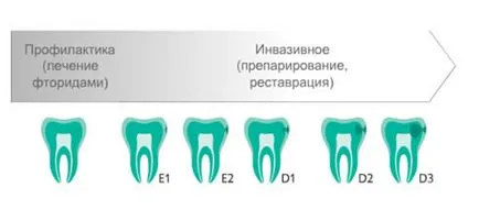 carie tratament fără pictograma de foraj, preț pe pictograma aplicației în lumea de stomatologie Dental