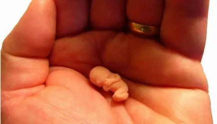 frunze de dafin pentru avort