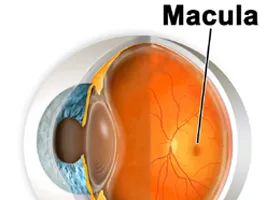 Macula - oftalmologie centru ophthalmica