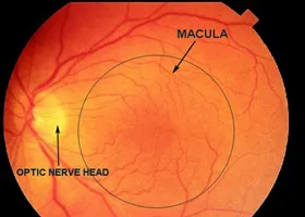 Macula - oftalmologie centru ophthalmica