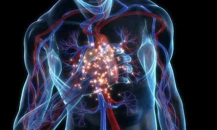 Microinfarction - primele semne și simptome, tratament, tablete si medicamente