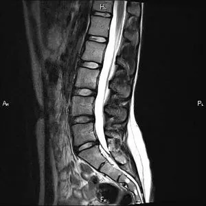 coloanei vertebrale RMN - adrese si preturi