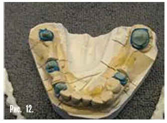 Dental-revue, articole, tehnologie ortopedice, fără metal, în stomatologie (m Sledkov