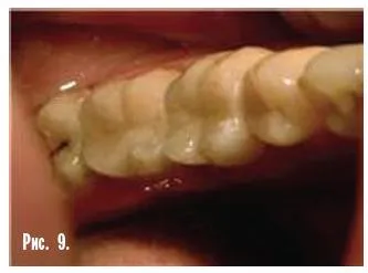 Dental-revue, articole, tehnologie ortopedice, fără metal, în stomatologie (m Sledkov