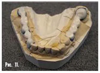 Dental-revue, articole, tehnologie ortopedice, fără metal, în stomatologie (m Sledkov