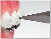 Ортодонтия, зъбна ортодонт център на Пятигорск