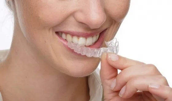 Избелване на зъби kapoy- подробно изясняване техника емайл
