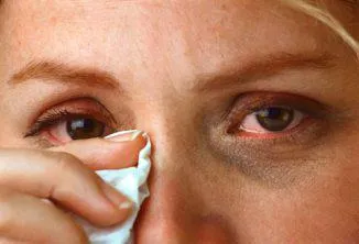 Зачервяване на лечение на очите у дома за възрастни и деца, причините и симптомите, как да се премахне сърбеж