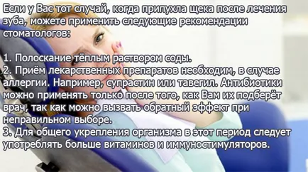 След третирането на зъба е подути бузите - причини и отстраняване