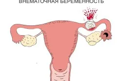 Blow на тръбите