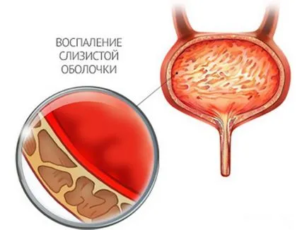 Cauzele dureri în timpul urinării la femei