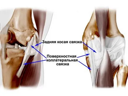 лечение на коляното сухожилие разкъсване на народни начини видео