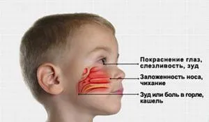 Ринит при деца симптоми и лечение