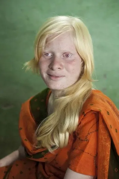 A világ legnagyobb albínó család