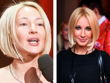 Magyar stars without makeup fotó