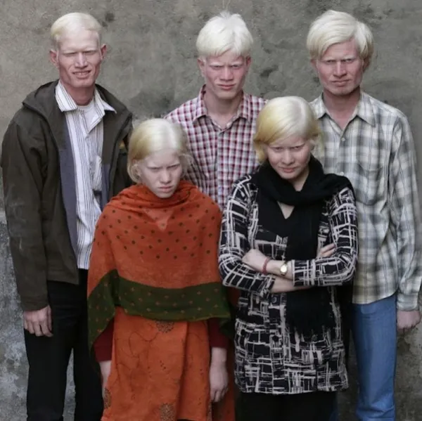 cea mai mare familie albinos din lume