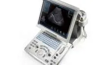 Köre az ultrahangos diagnózis az orvostudomány