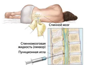 Наранявания и гръбначния стълб и наранявания на гръбначния стълб, както травма лечение и руптура