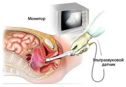 ecografie ginecologică în Omsk